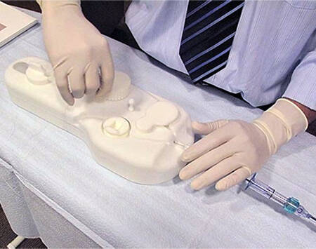 prototype of a tensioning device used for tightening the mitral annulus of the heart
